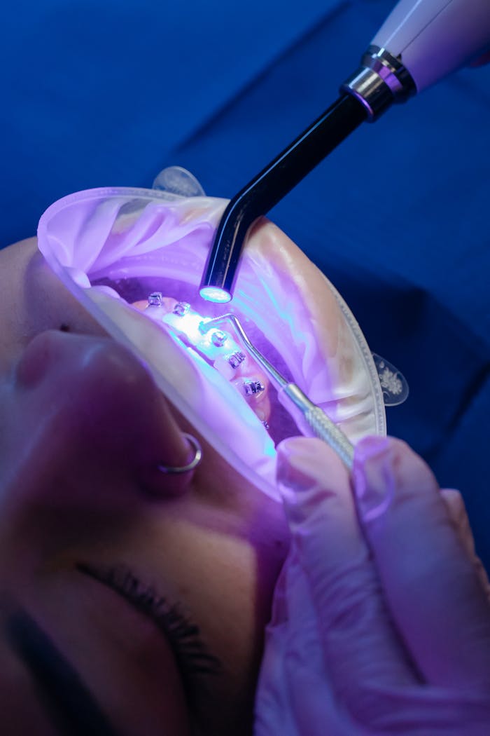 The Art of Drawing Readers In: Your attractive post title goes here Close-up of a dental procedure using a UV light on braces for orthodontic treatment.