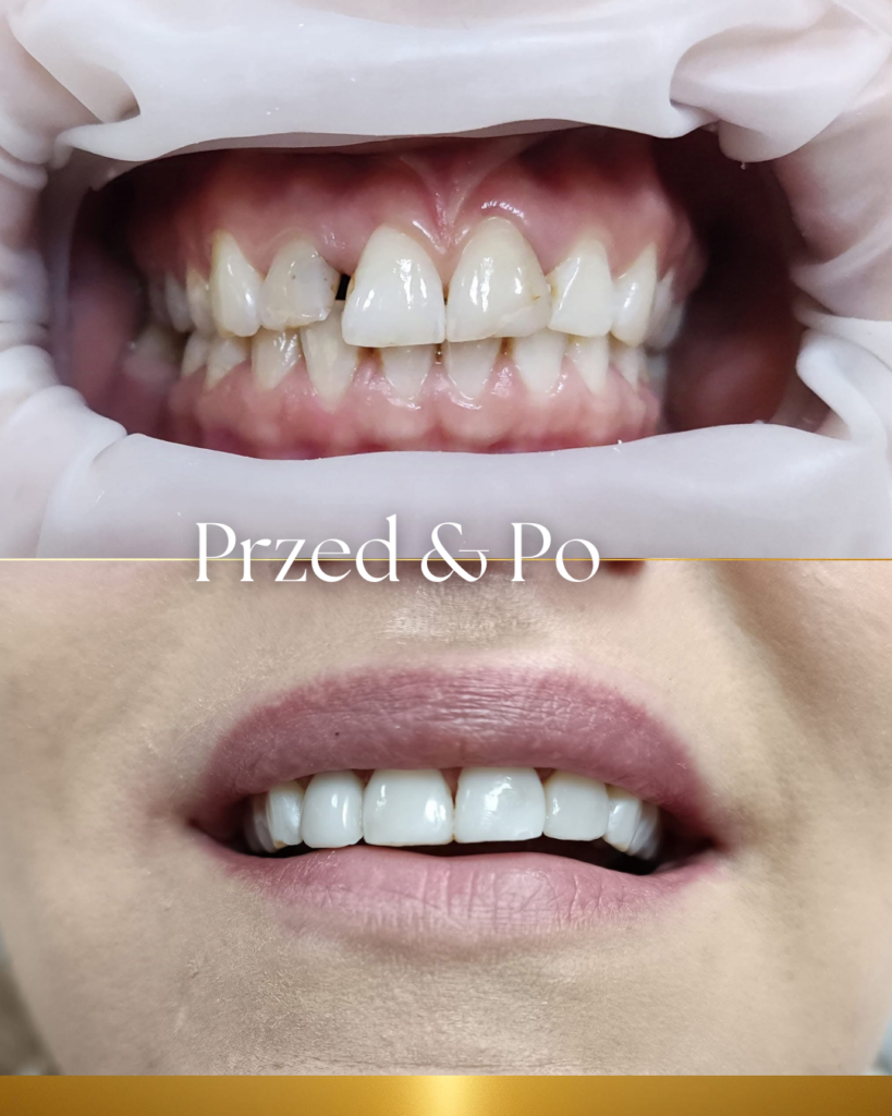 Stomatologia laserowa Piotrków Trybunalski zdjęcie realizacji
